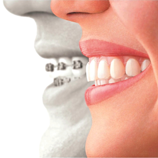 dr. ellen im pediatric dentistry clearcorrect