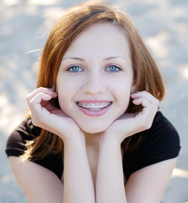 girl with braces in poway ca